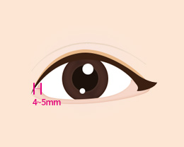procedures02