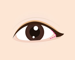 procedures01