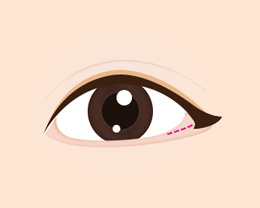 procedures01