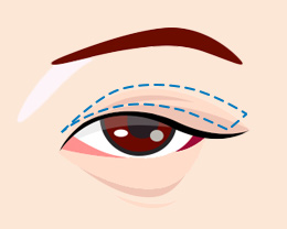 procedures01