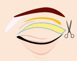 procedures02