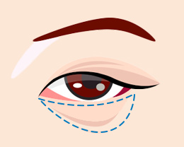 procedures01