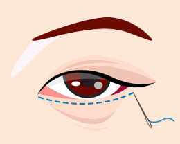 procedures03