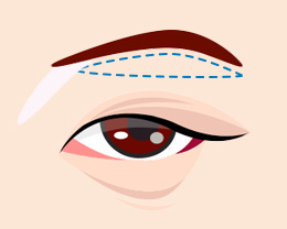 procedures01