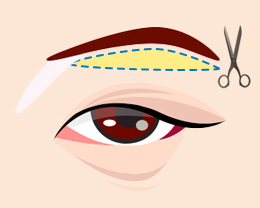 procedures02