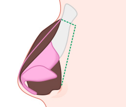 procedures02