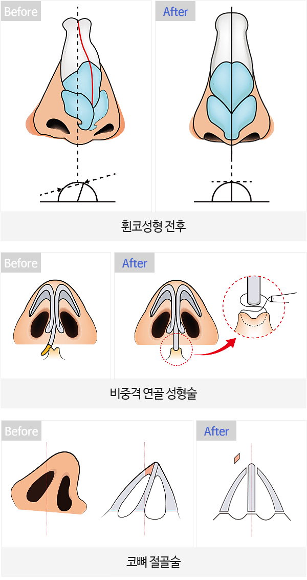 procedure