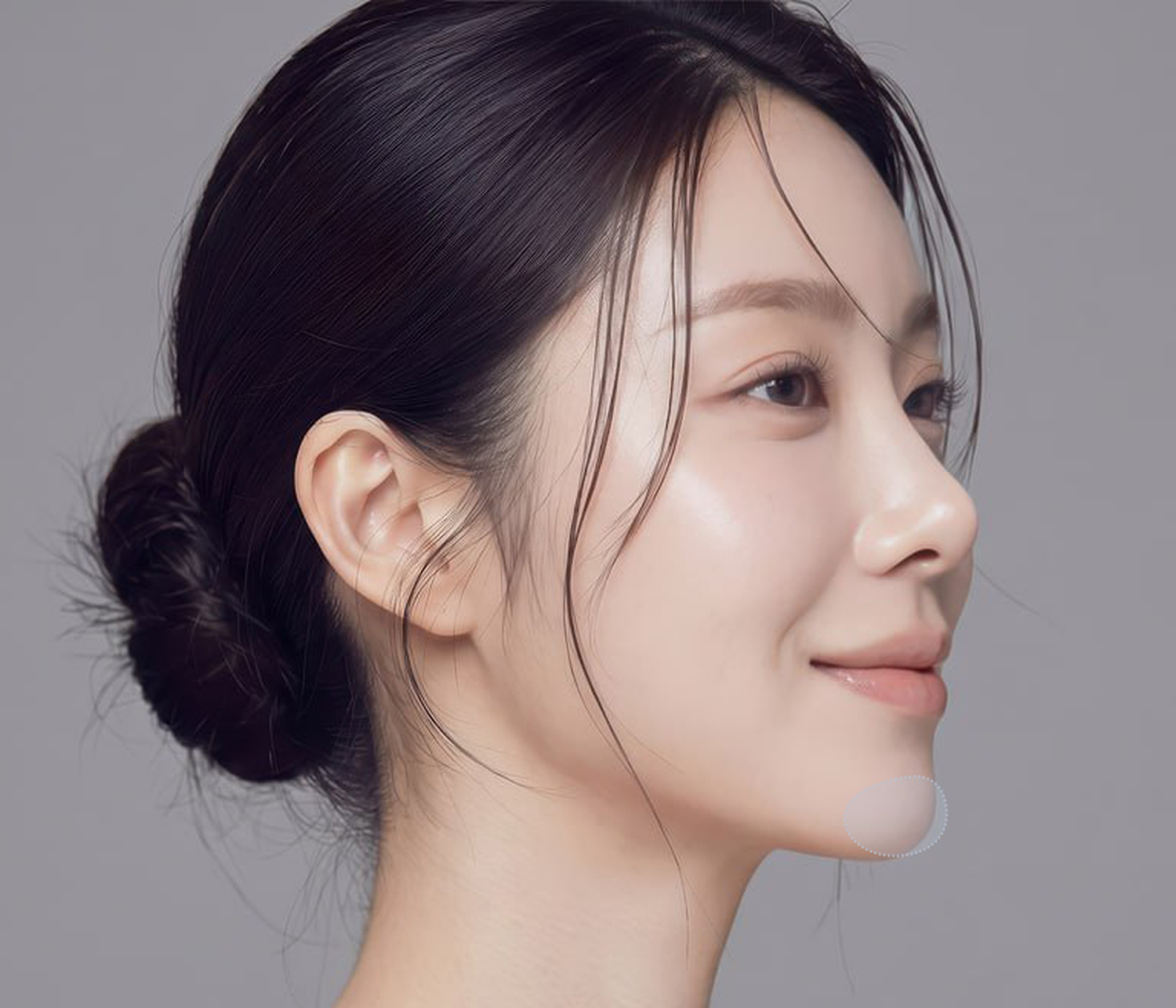 무턱성형
