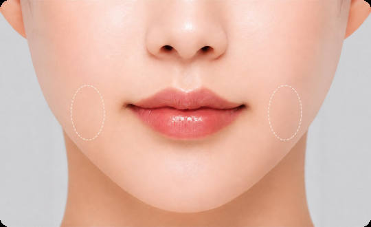맞춤 보조개 디자인