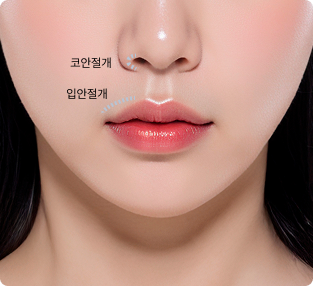 절개 및 공간 확보