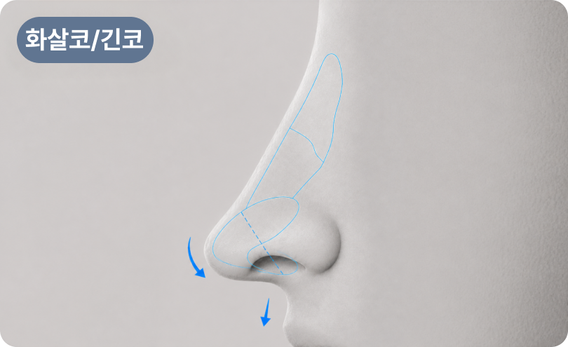 화살코/긴코 유형 정밀 분석