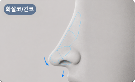 화살코/긴코 유형 정밀 분석