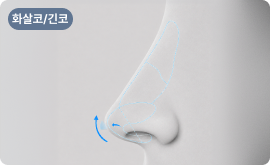 코라인 및 비율 개선