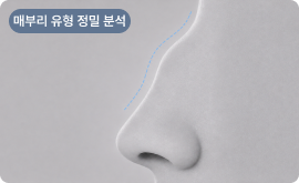 매부리 유형 정밀 분석