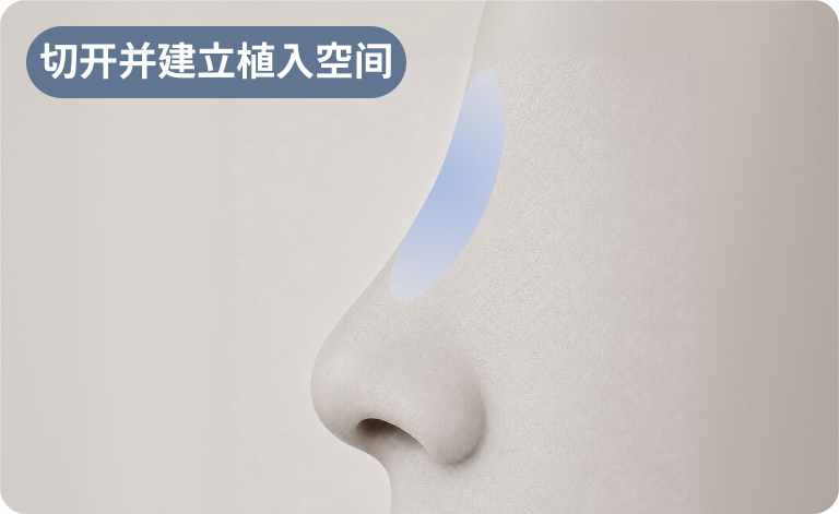 切开后建立植入空间