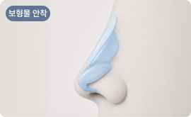코끝 교정 및 보형물 안착