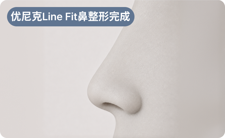 优尼克Line Fit鼻整形完成